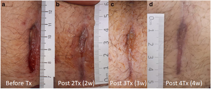 Fig. 2