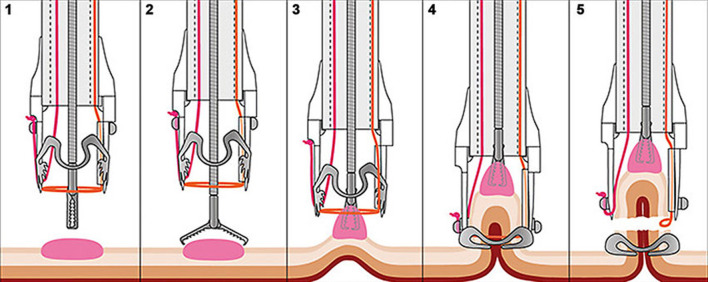 Fig. 2