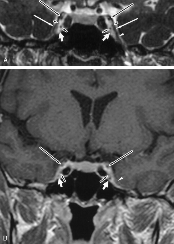 Fig 2.