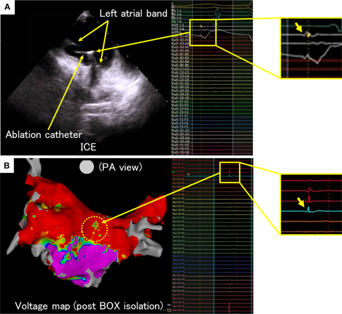 Figure 2