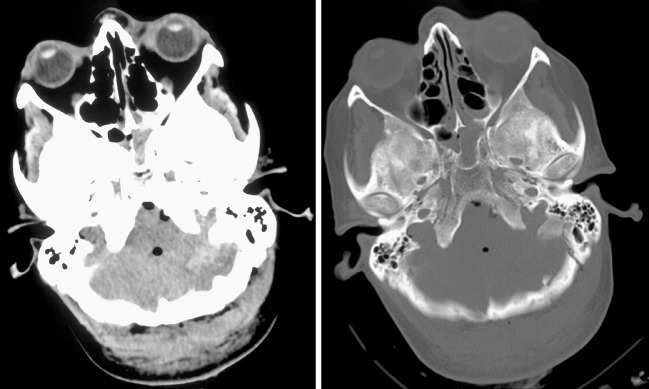 Fig. 1