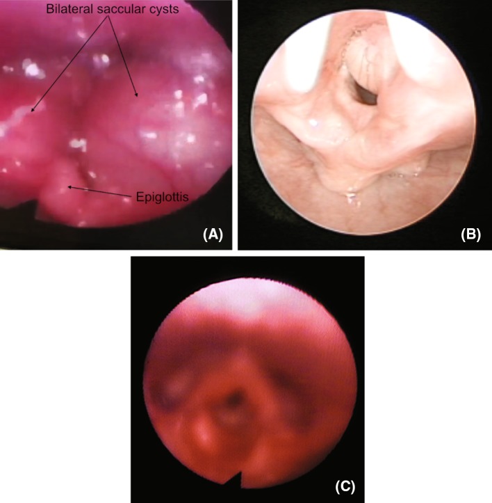 Fig. 3
