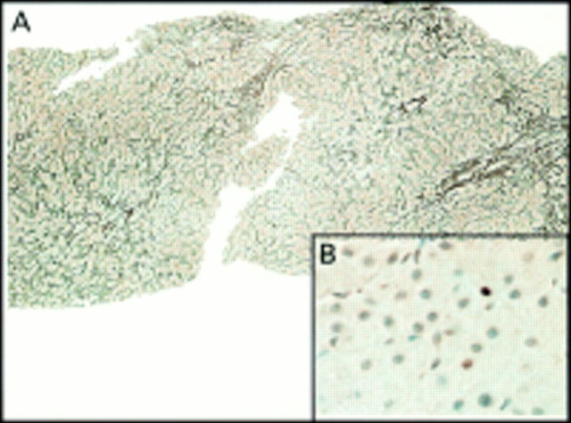 Figure 4  