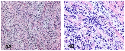 Figure 4A,B