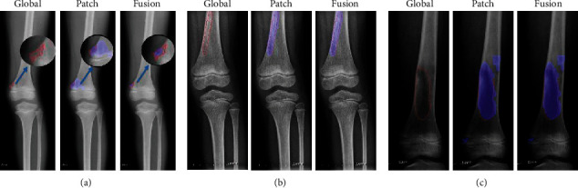 Figure 16