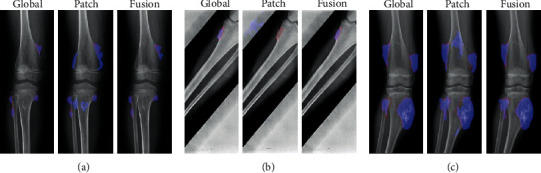 Figure 15