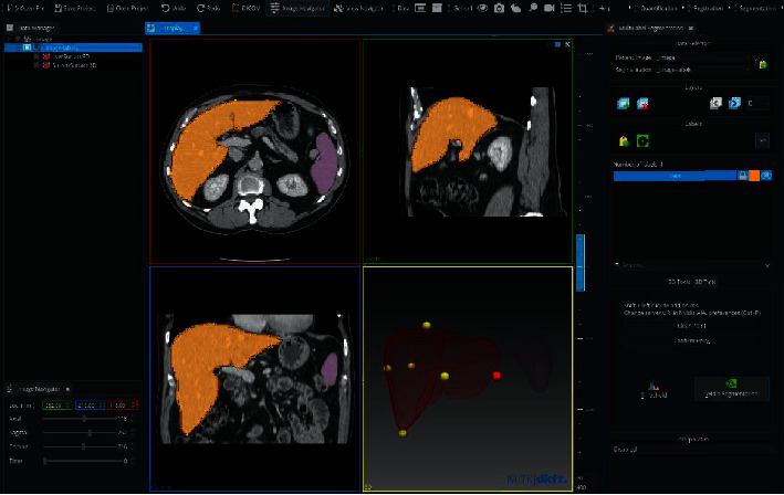 Figure 21