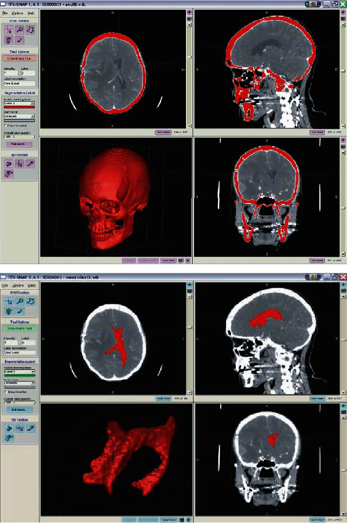 Figure 20