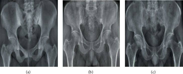 Figure 11