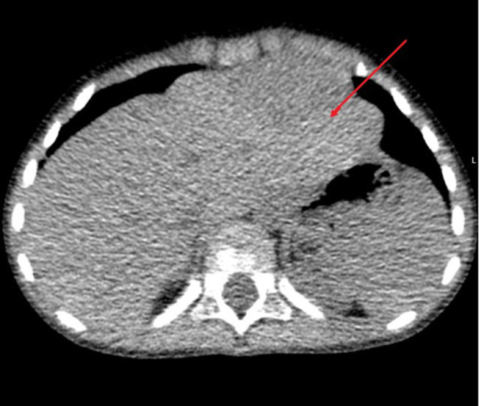 Fig 3