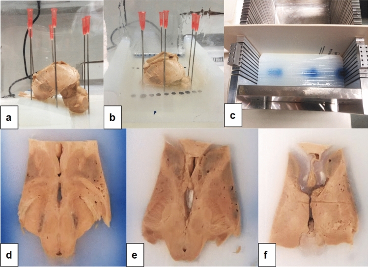 Fig. 17