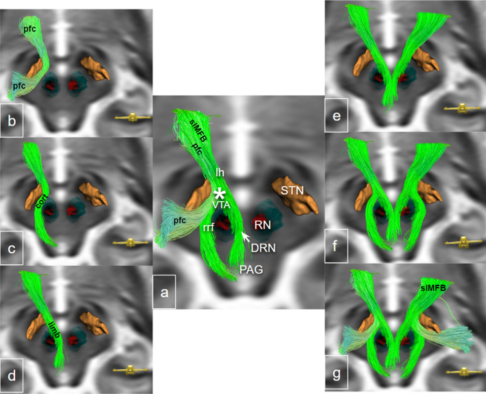 Fig. 12