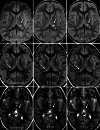 FIG 3.