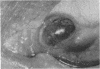51