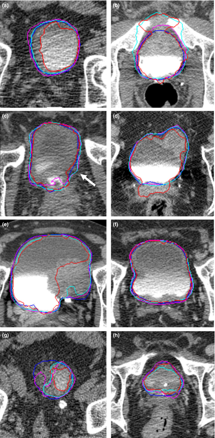 Figure 7