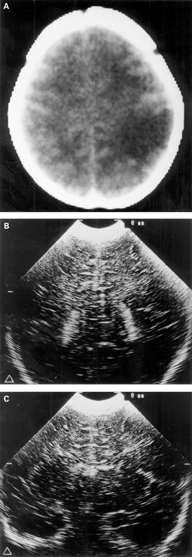 Figure 2  