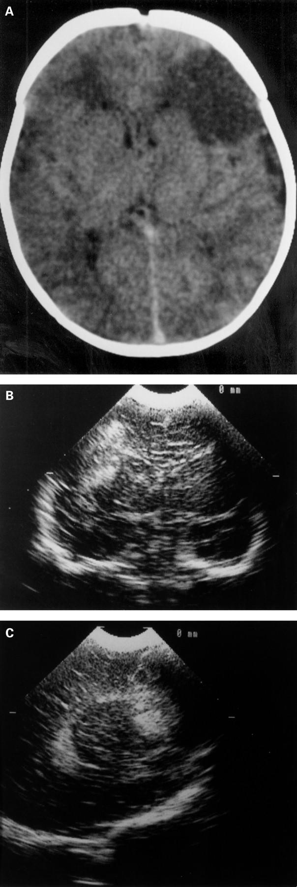 Figure 1  