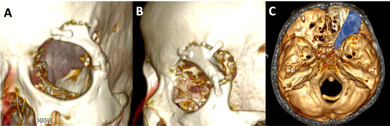 Figure 6