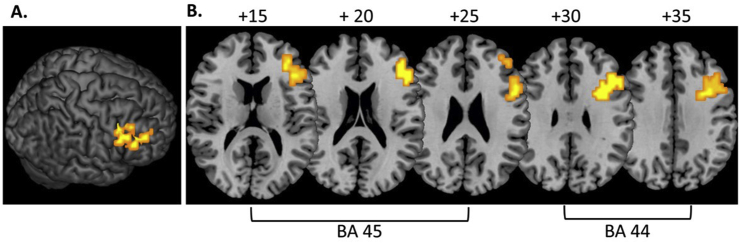 Fig. 1