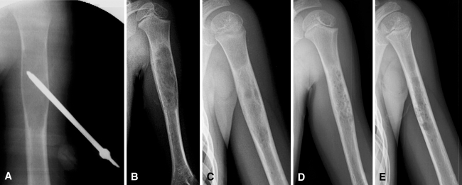 Fig. 1A–E