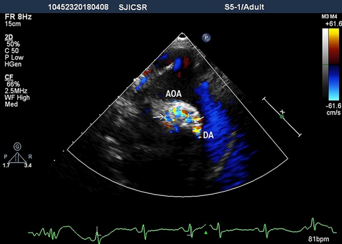 Figure 4