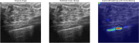 Fig. 28