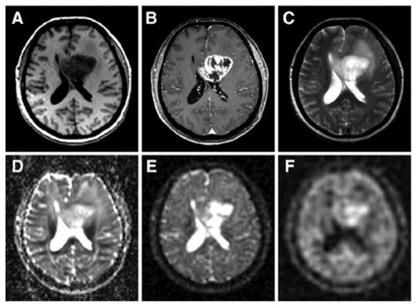 Fig. 11