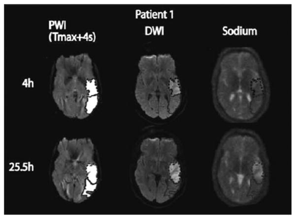 Fig. 10