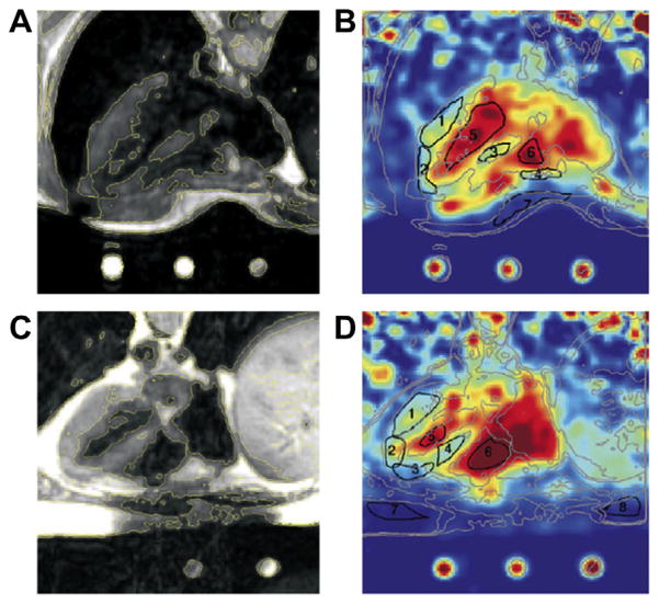 Fig. 14