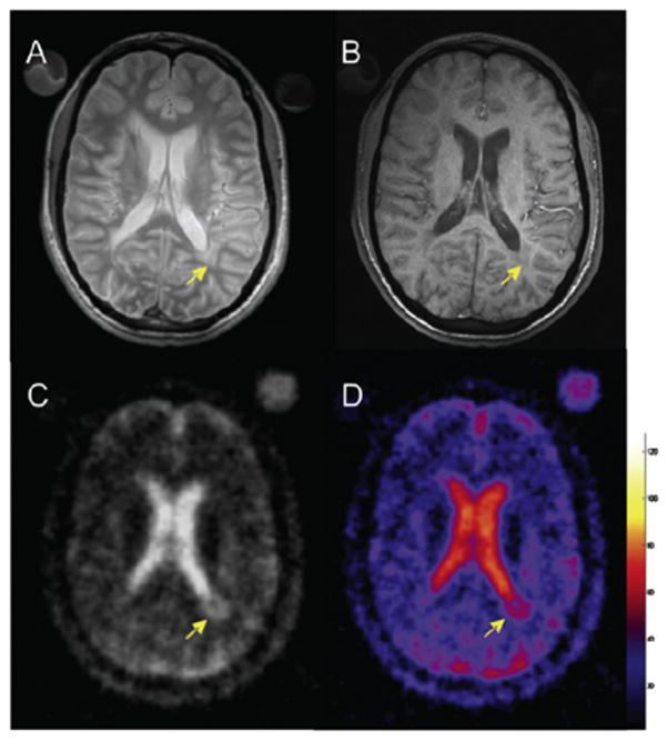 Fig. 12