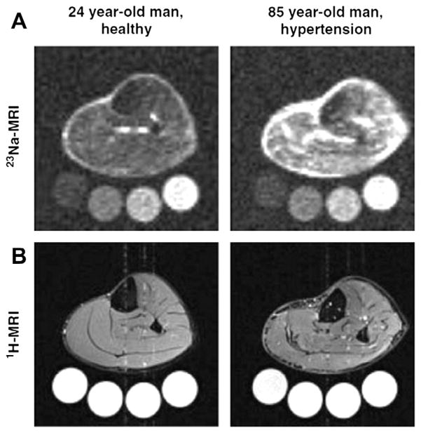 Fig. 16