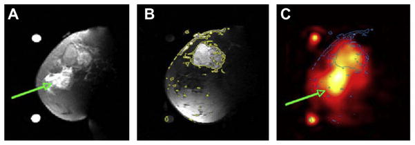 Fig. 13