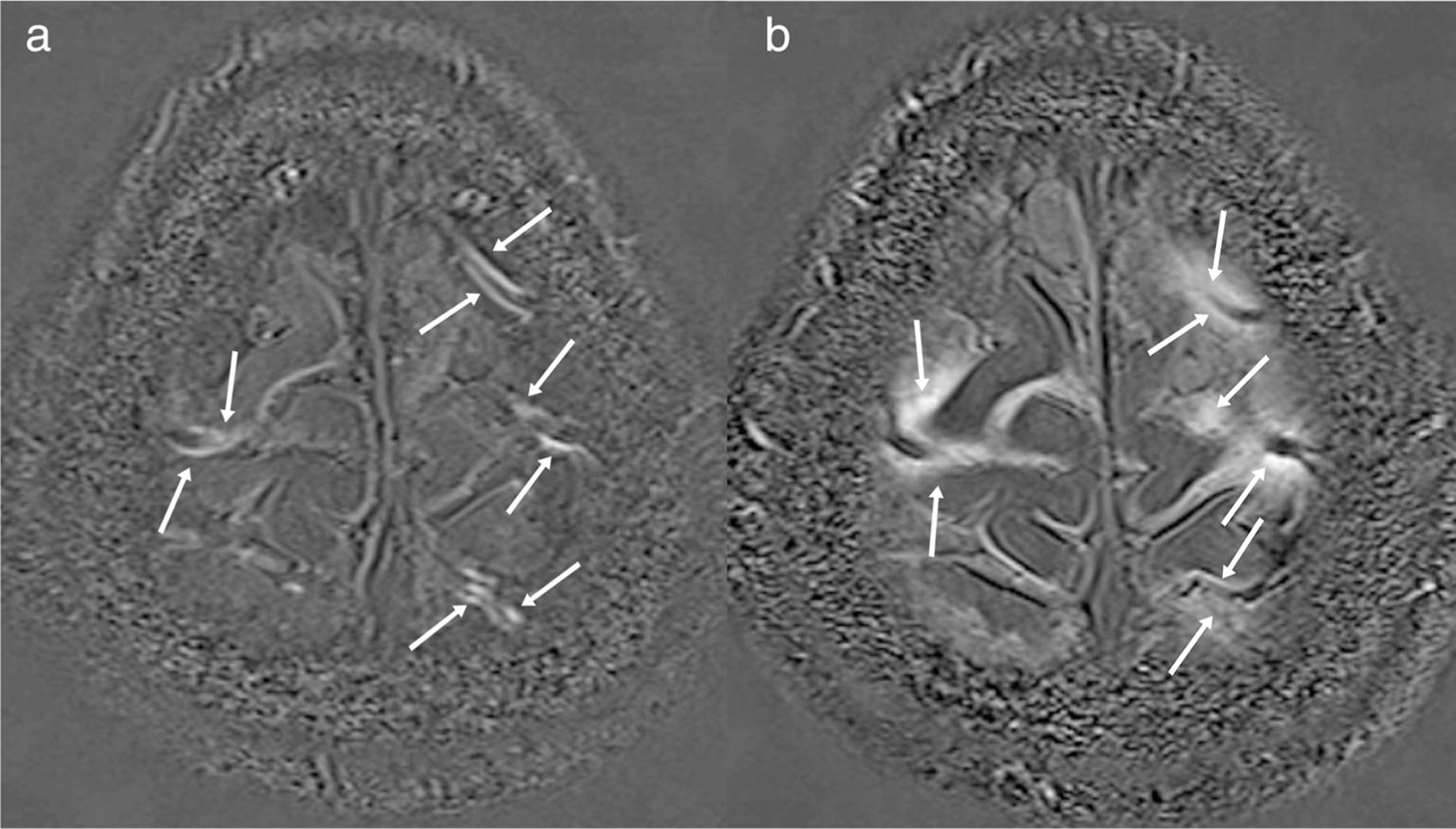 FIGURE 9: