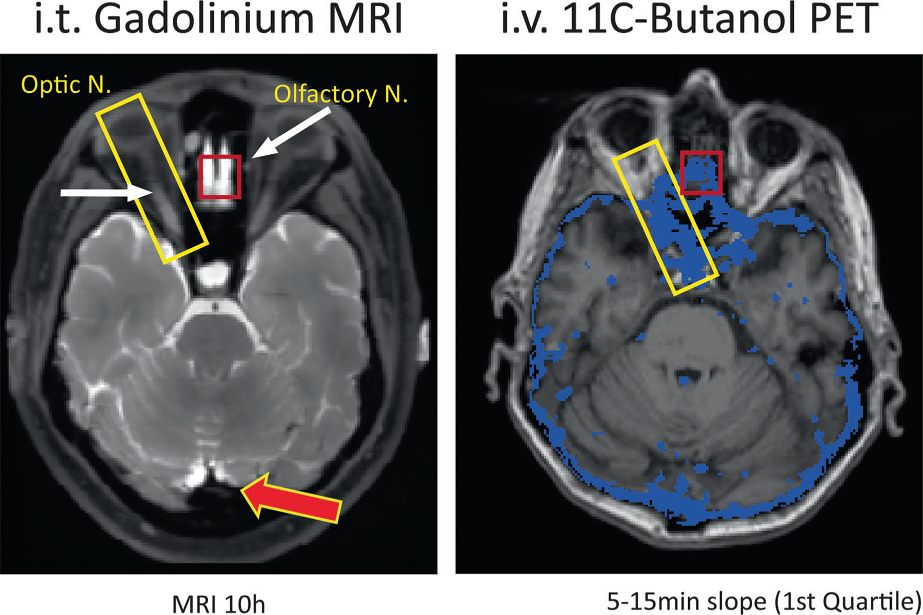 FIGURE 11: