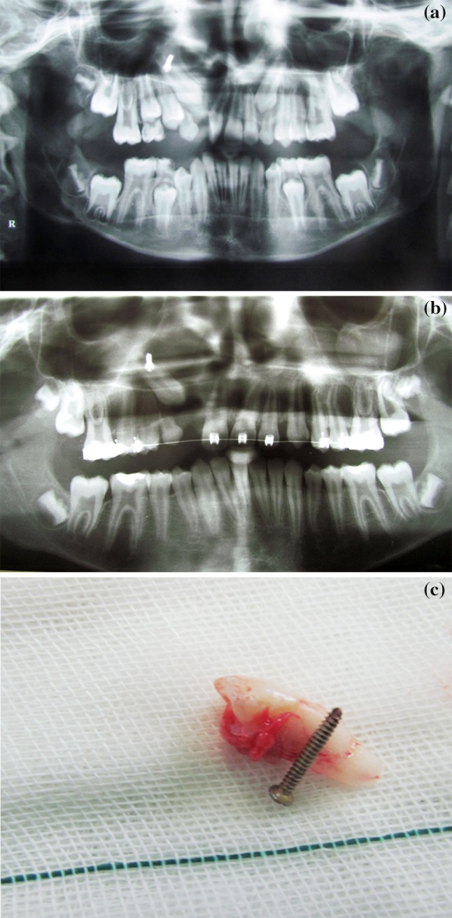 Fig. 3