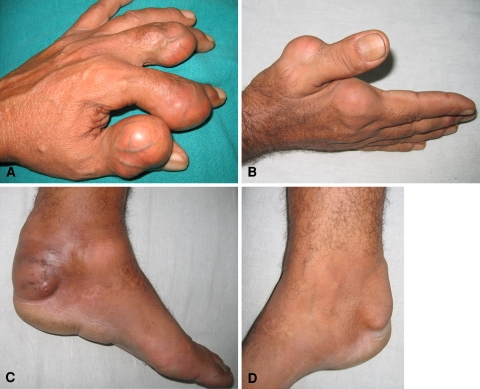Fig. 1A–D