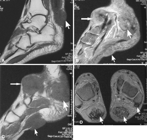 Fig. 3A–D