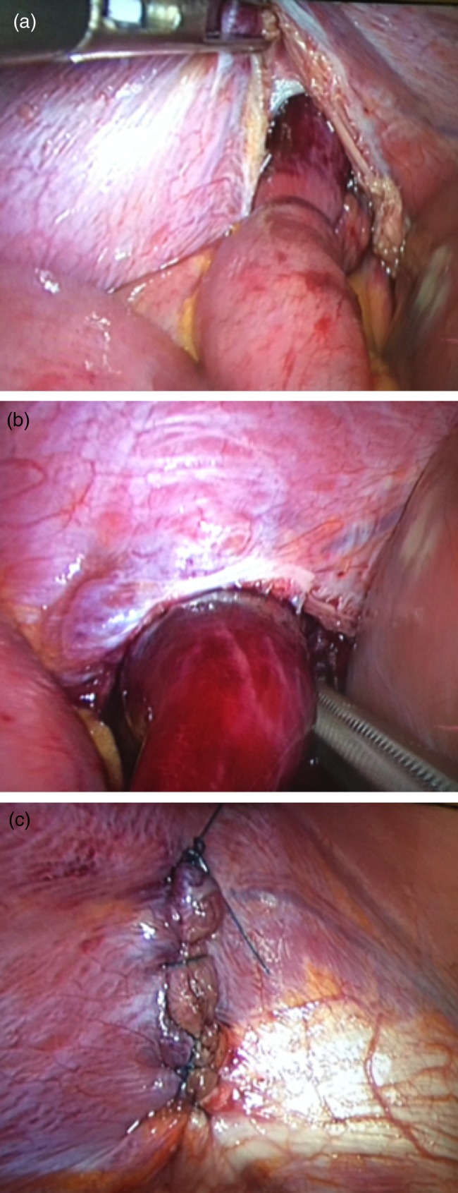 Figure 2: