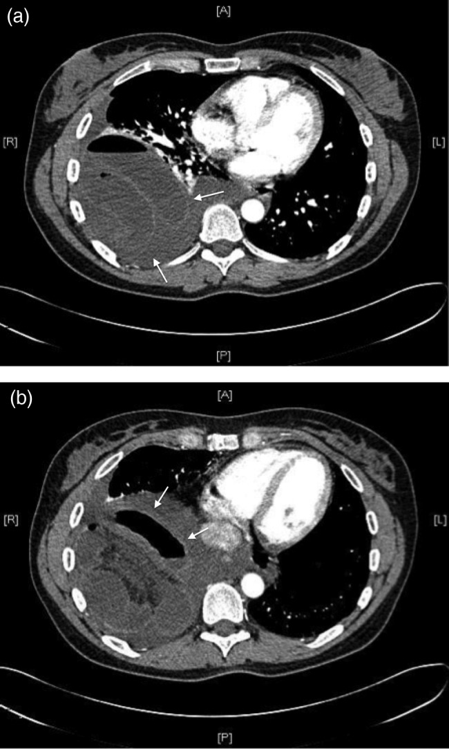 Figure 1: