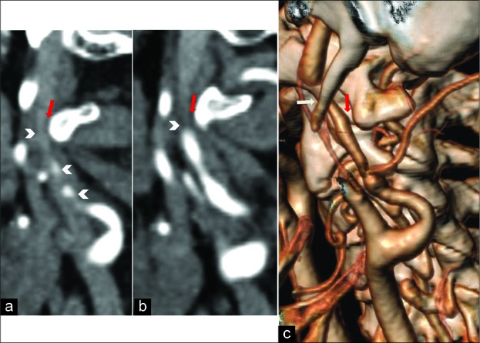 Figure 1: