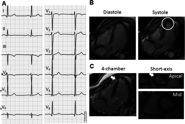 Fig. 2