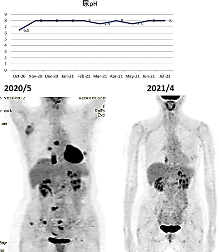 Figure 11