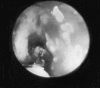 Figure 2B