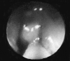 Figure 2A