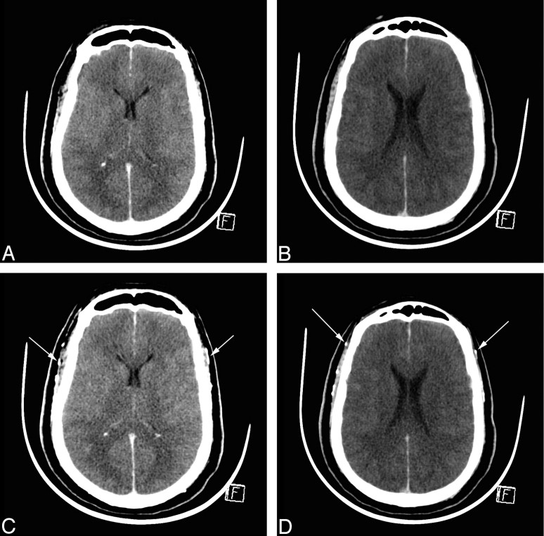 Fig 2.