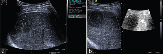 Figure 15