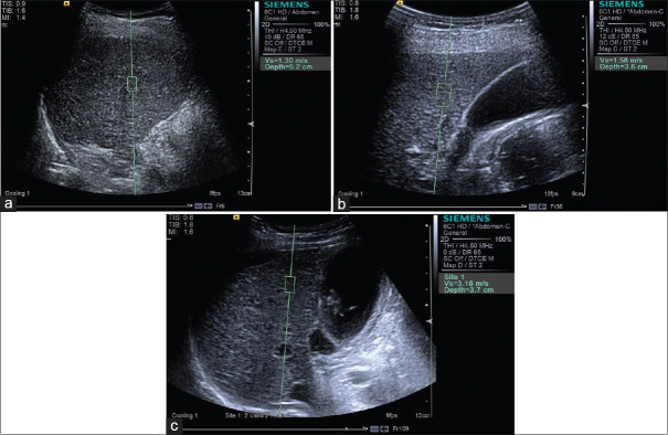 Figure 12