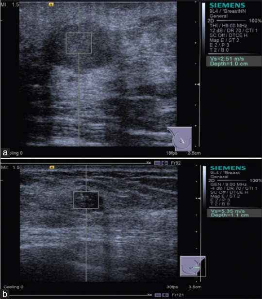 Figure 17