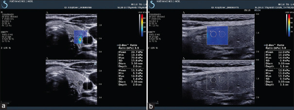 Figure 20