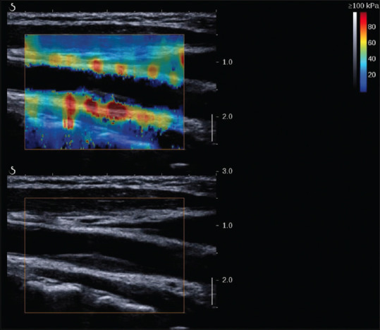 Figure 22